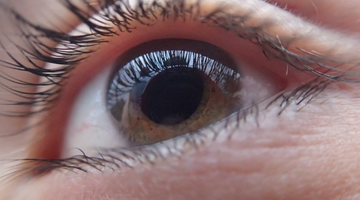 The Ways in Which CBD Affects Glaucoma